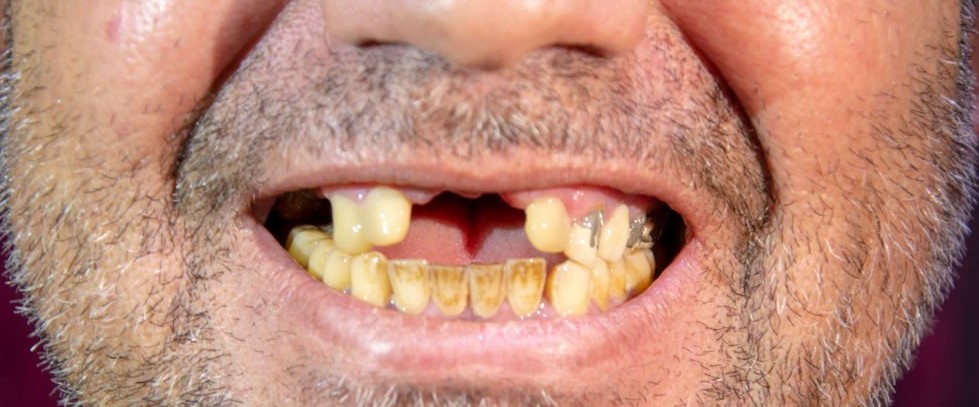 Example dental photo submitted for analysis